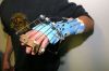 Handchirurgie010.jpg